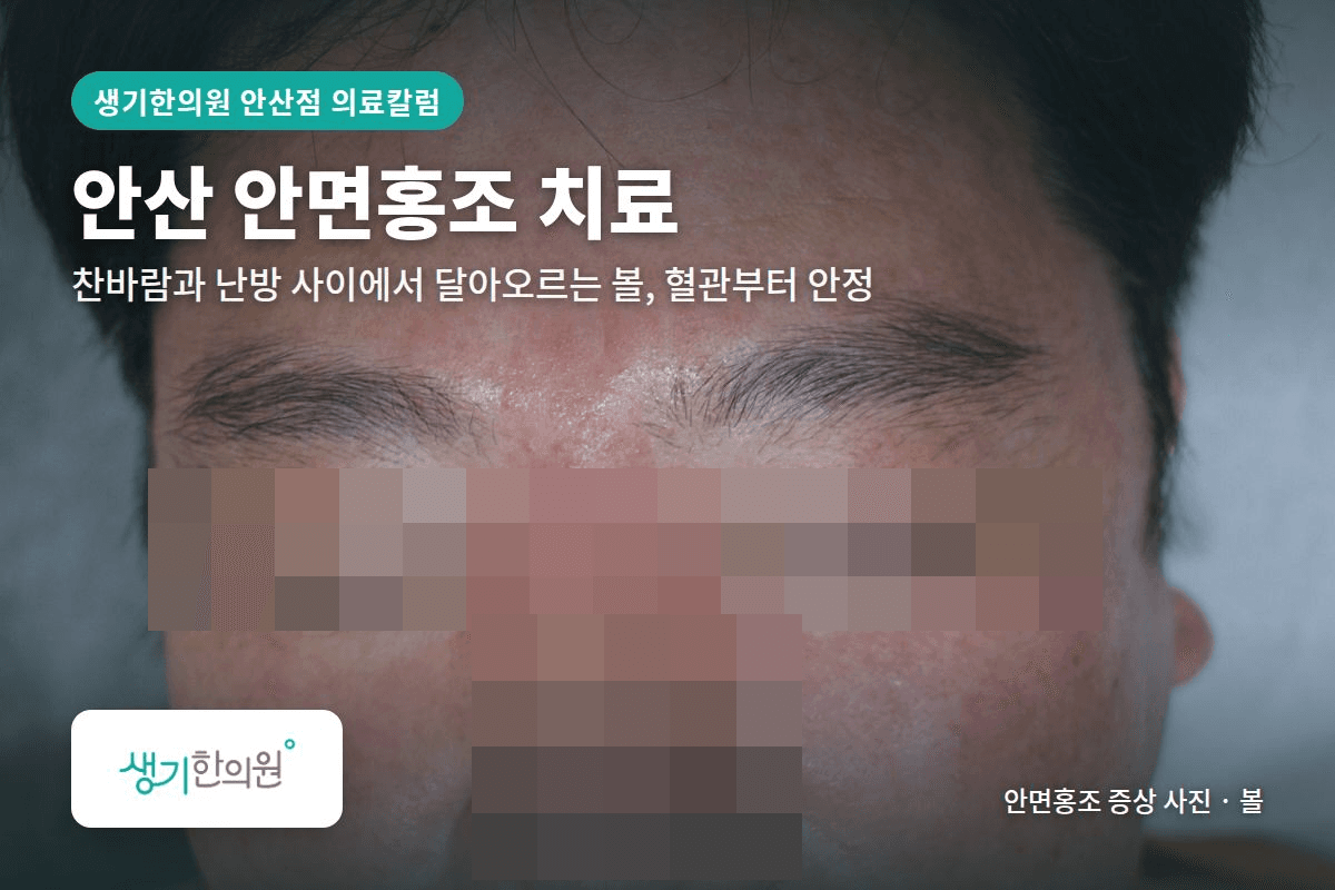 볼 안면홍조 증상 사진과 문구 「안산 안면홍조 치료, 찬바람과 난방 사이에서 달아오르는 볼, 혈관부터 안정 · 생기한의원 안산점」